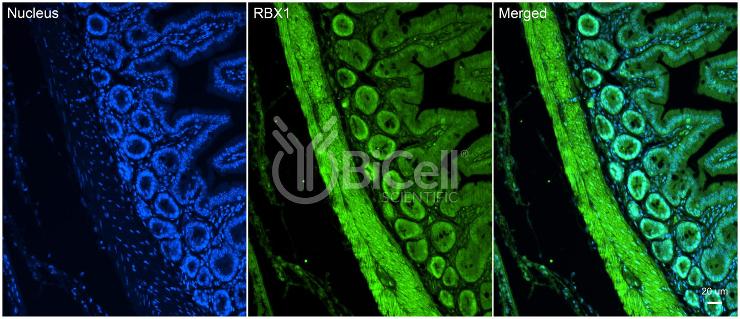 RBX1 (ROC1) Antibody - FFPE Validated