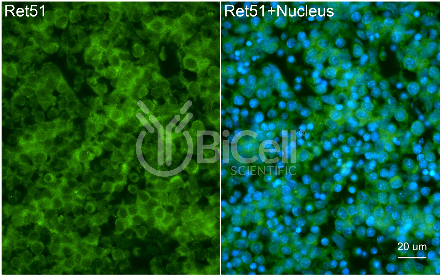 RET51 (RET or CDHF12 or CDHR16) Antibody