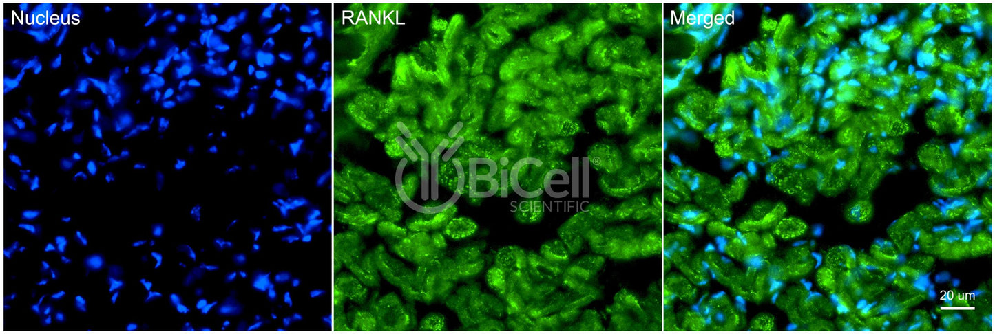 TNFSF11 (RANKL or CD254) Antibody - Western Blot Validated