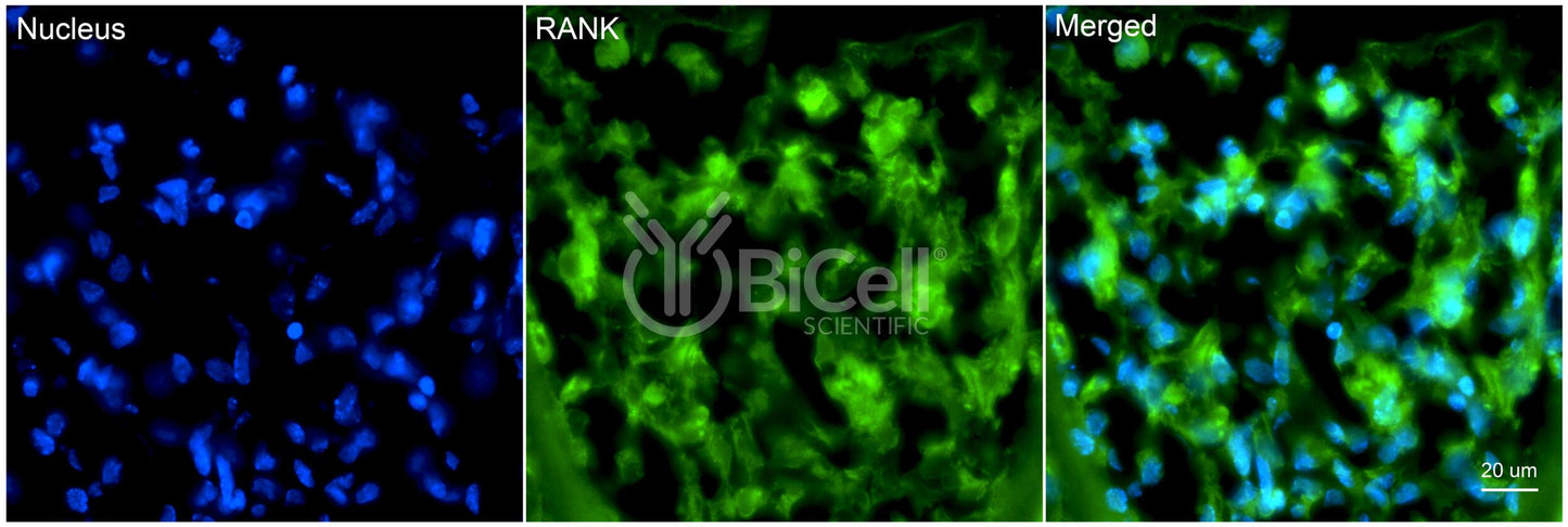 TNFRSF11A (RANK or CD265) Antibody