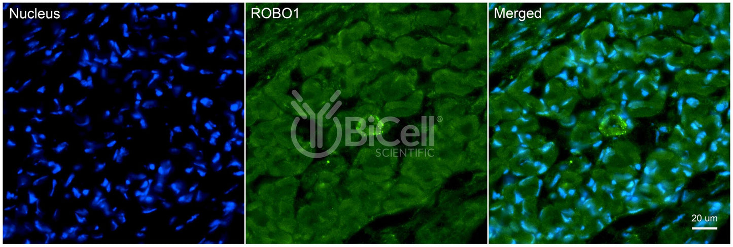 ROBO1 Antibody