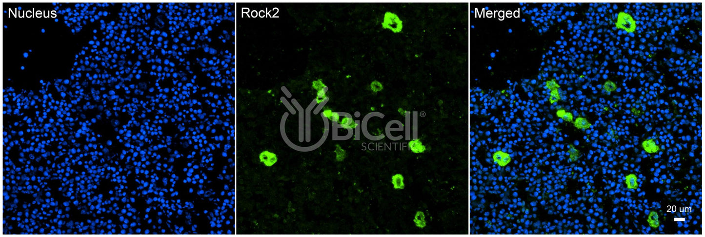 ROCK2 Antibody