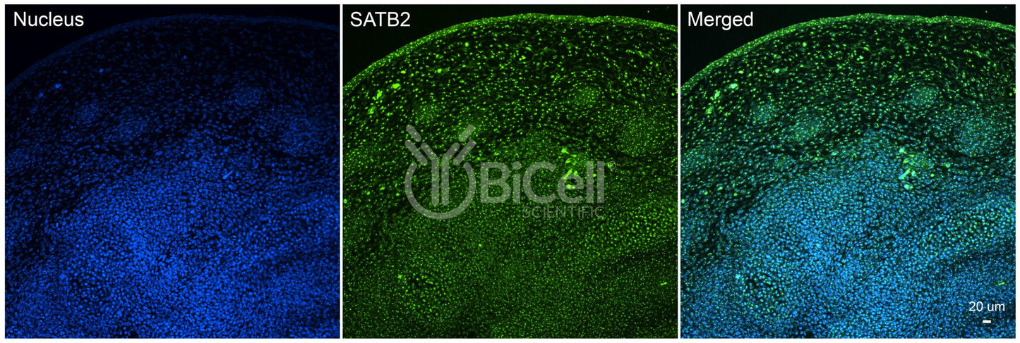 SATB2 Antibody - Western Blot Validated
