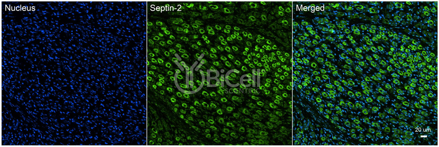 SEPTIN2 (SEPT2 or NEDD5) Antibody