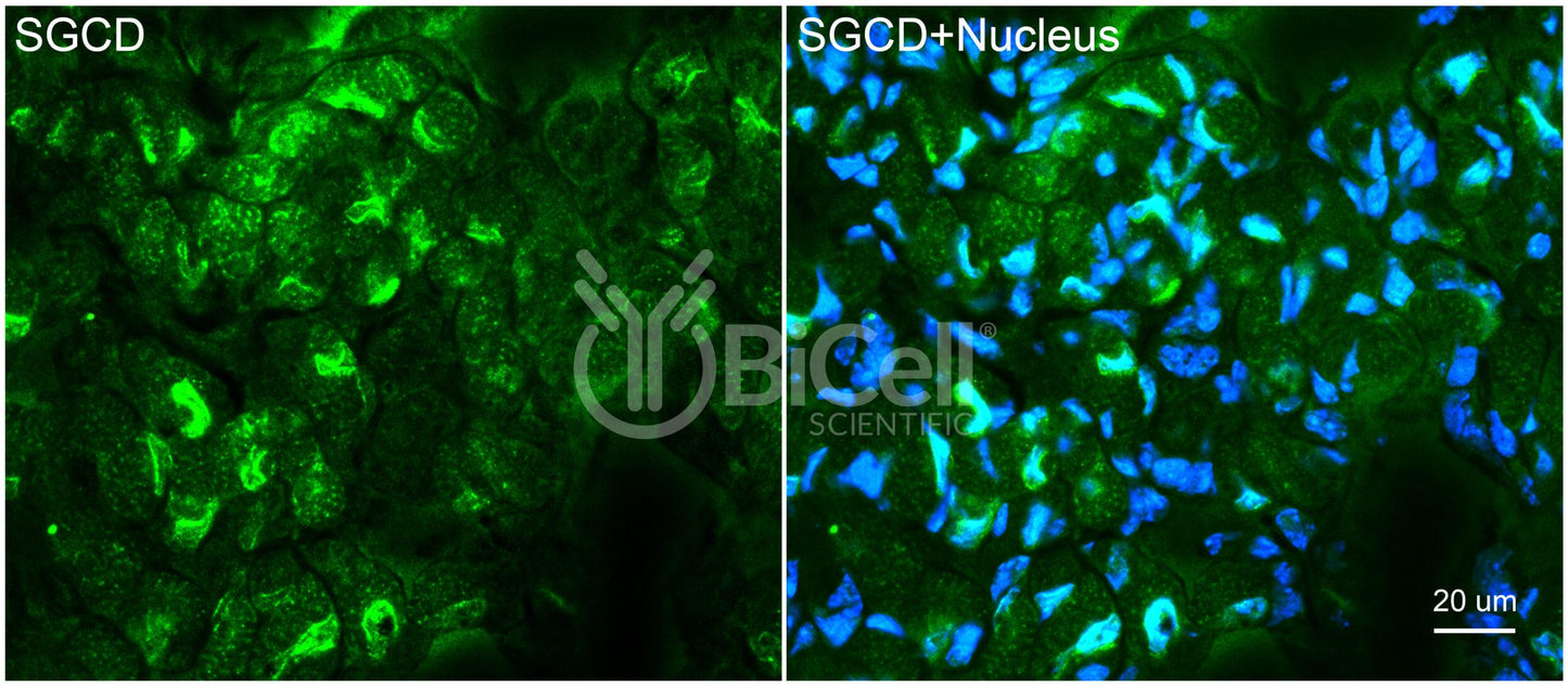 Sarcoglycan Delta (SGCD) Antibody - FFPE Validated