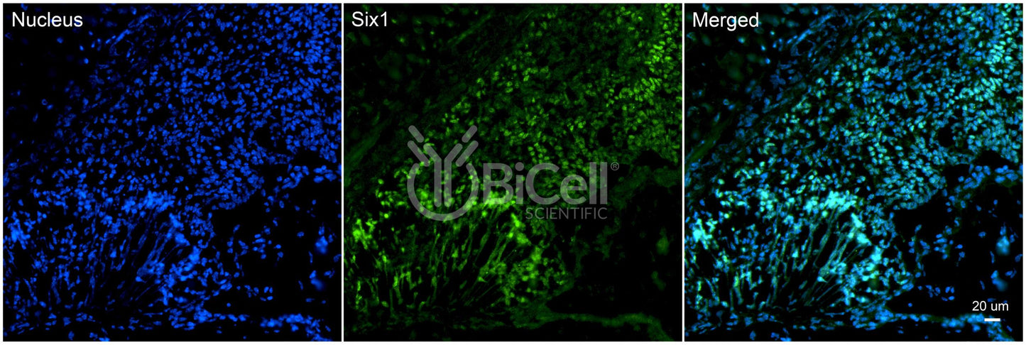SIX1 (DFNA23) Antibody - FFPE Validated