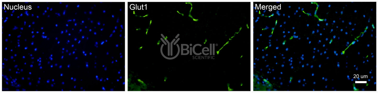GLUT1 (SLC2A1) Antibody - FFPE Validated