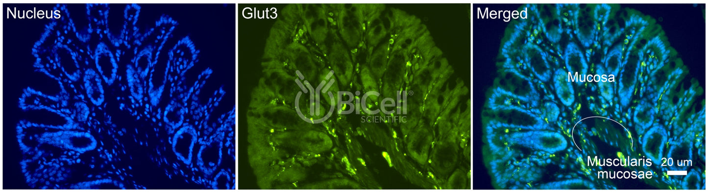 GLUT3 (SLC2A3) Antibody - FFPE Validated