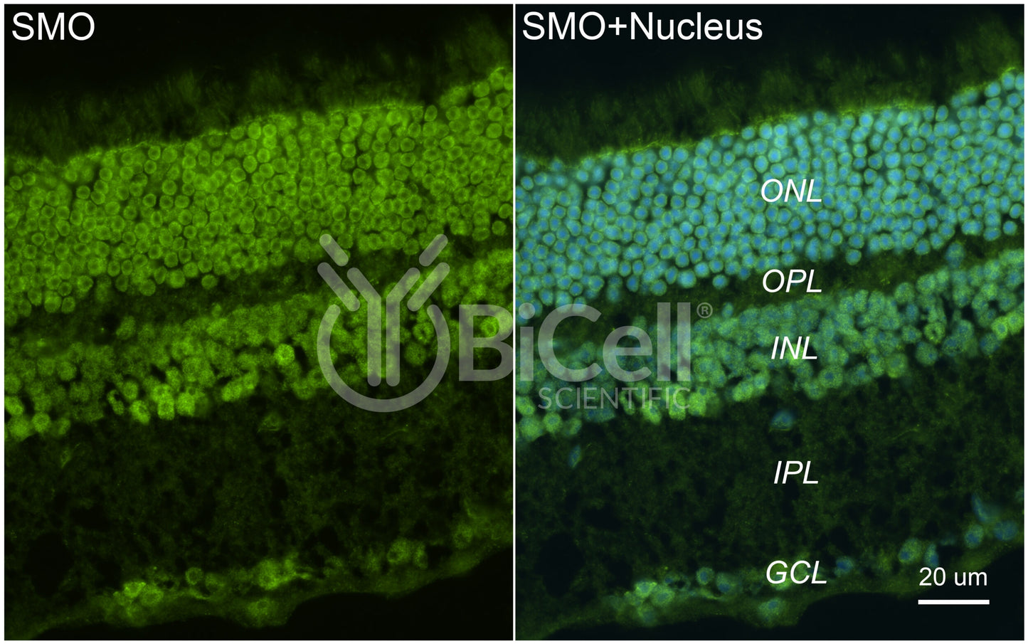 Smoothened (SMO or Frizzled-11 or FZD11) Antibody - Western Blot Validated