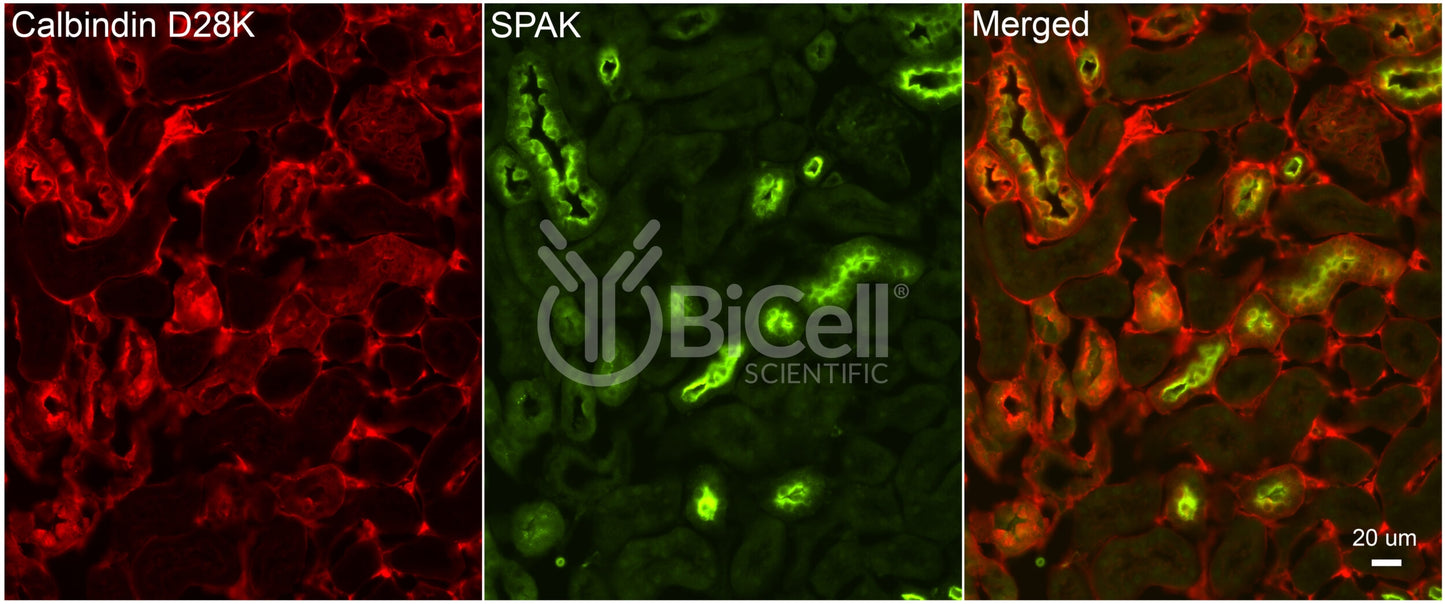 STK39 (SPAK) Antibody