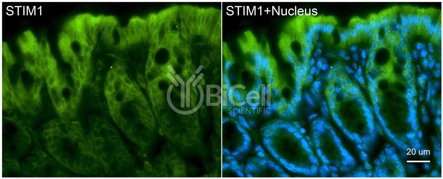STIM1 (TAM1) Antibody - Western Blot Validated