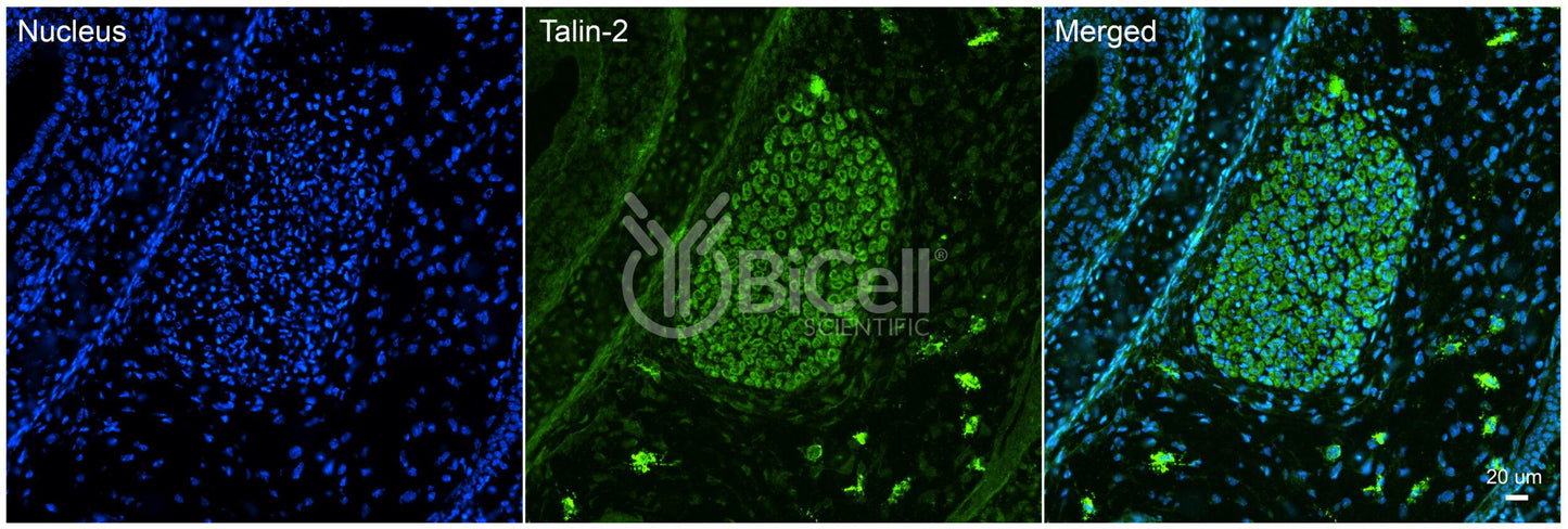Talin-2 (TLN2) Antibody