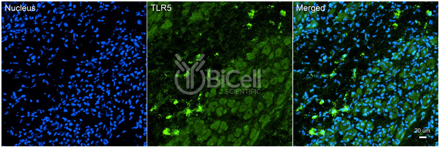 Toll-like receptor 5 (TLR5 or CD285) Antibody - FFPE Validated
