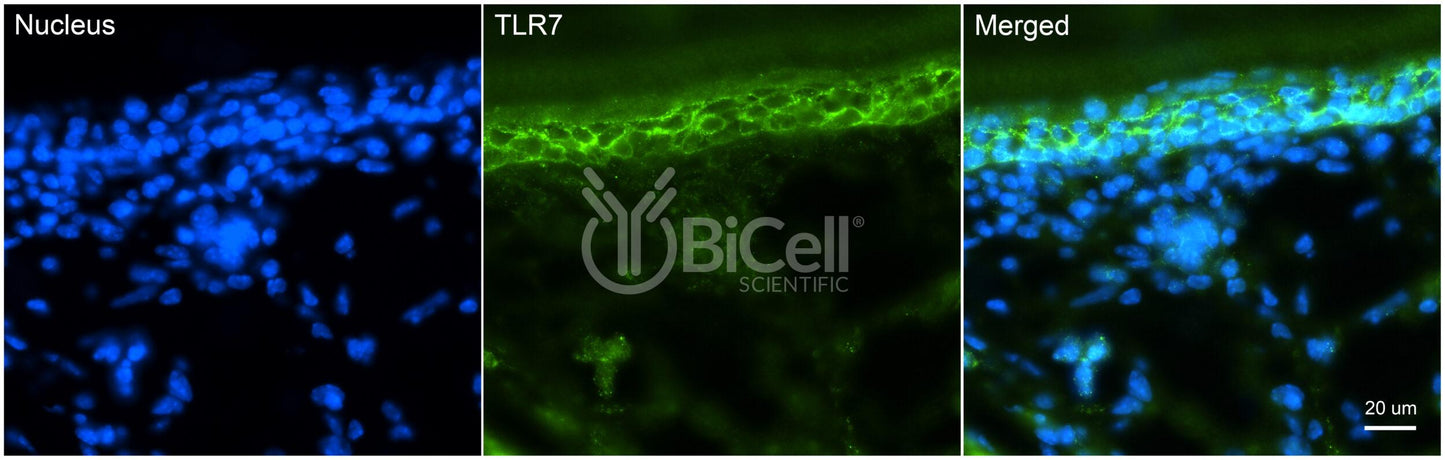 Toll-like receptor 7 (TLR7 or CD287) Antibody - Western Blot Validated