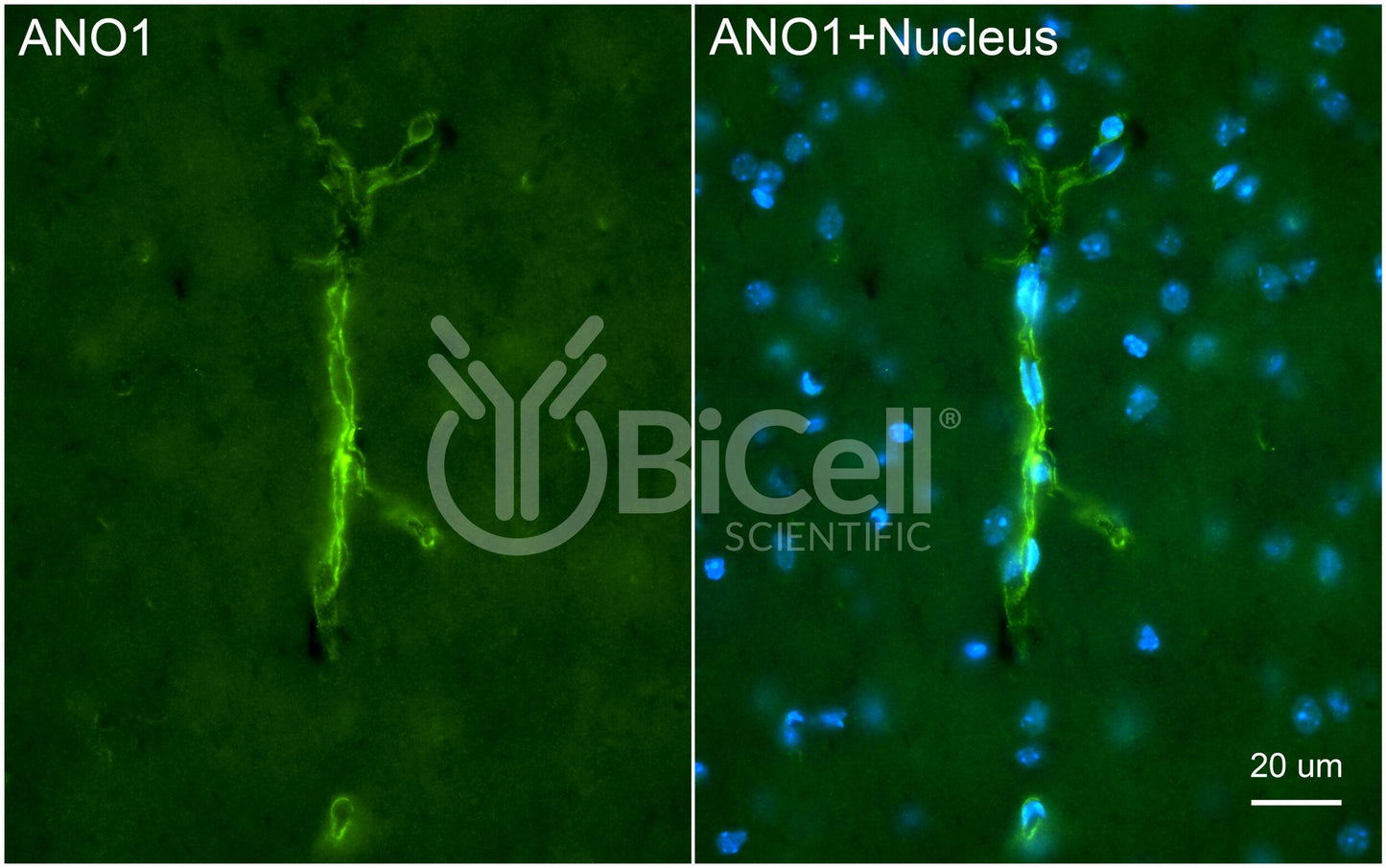 Anoctamin-1 (ANO1 or TMEM16A) (N-Terminus) Antibody - FFPE Validated