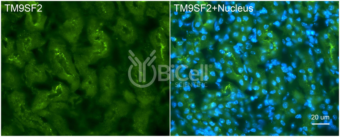 TM9SF2 Antibody