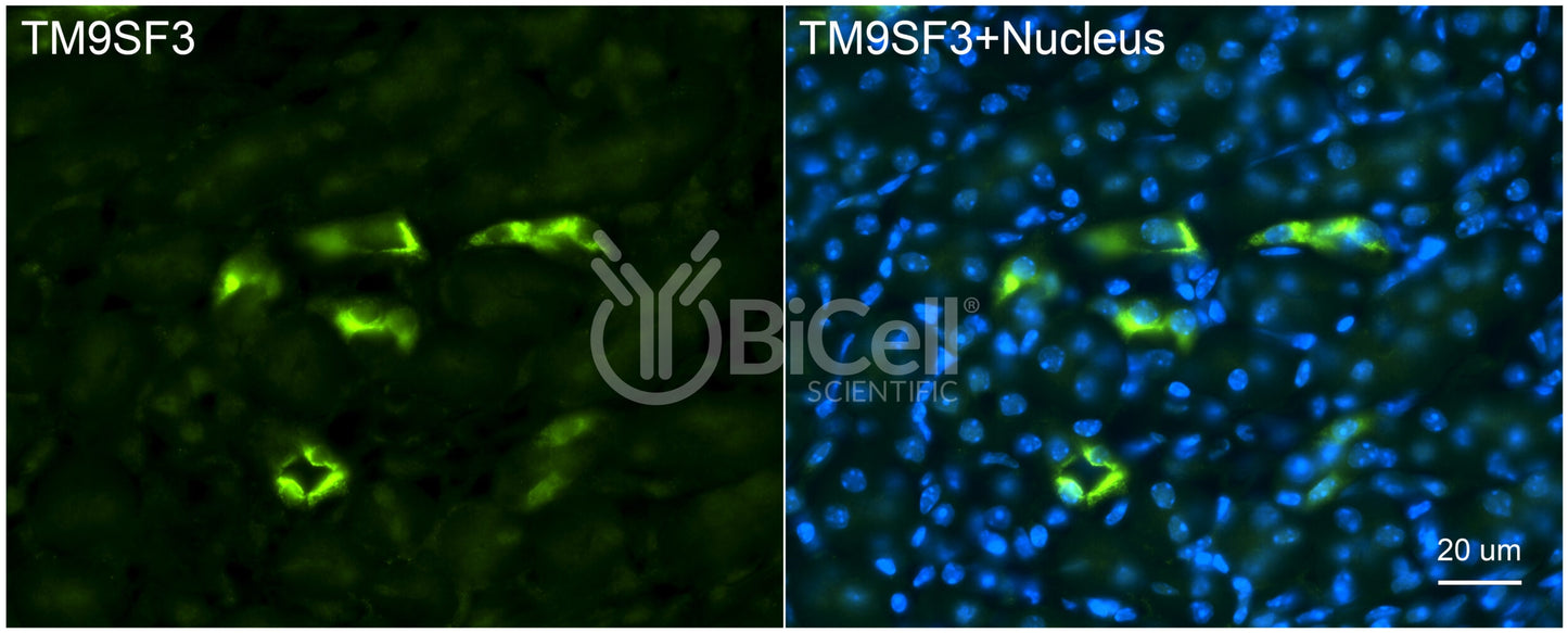TM9SF3 Antibody - FFPE Validated