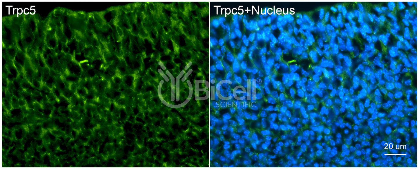 Trpc5 (C-Terminus) Antibody