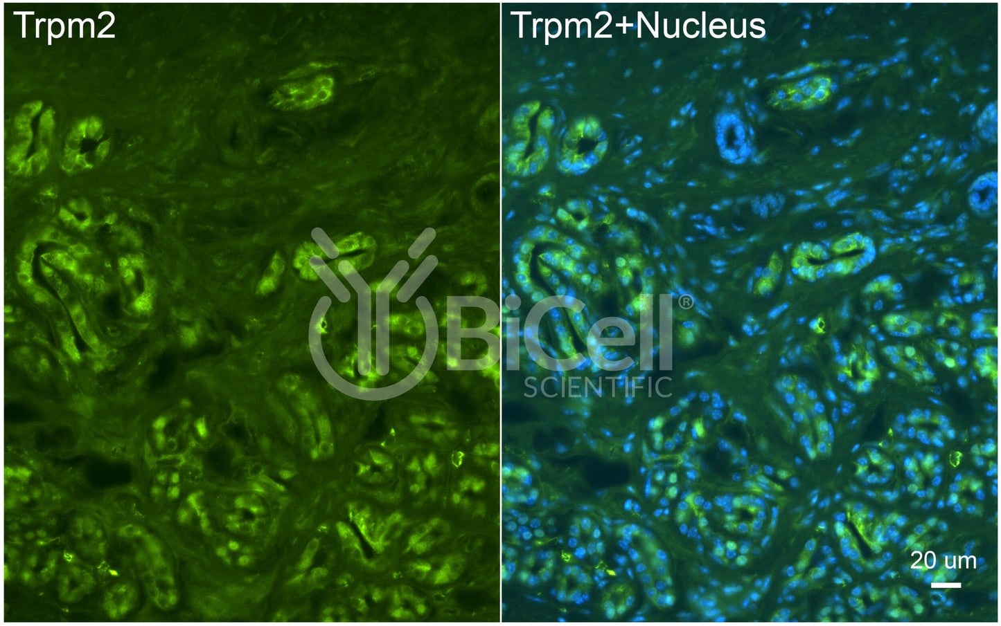 Trpm2 Antibody