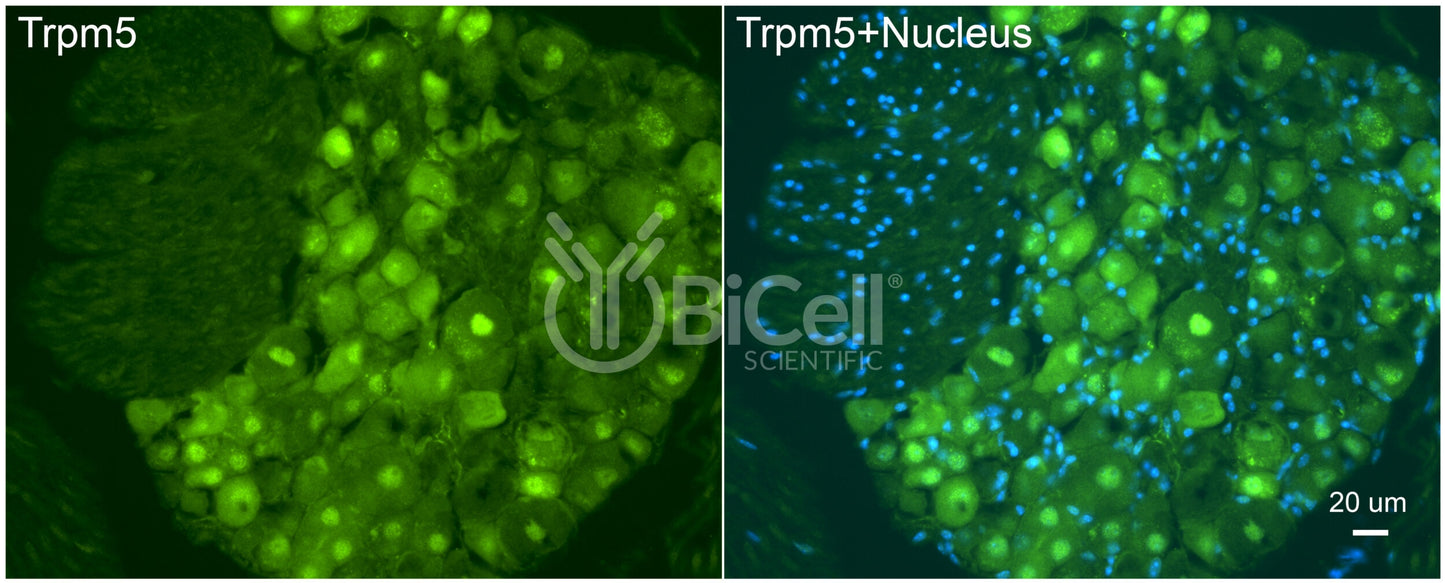 Trpm5 Antibody