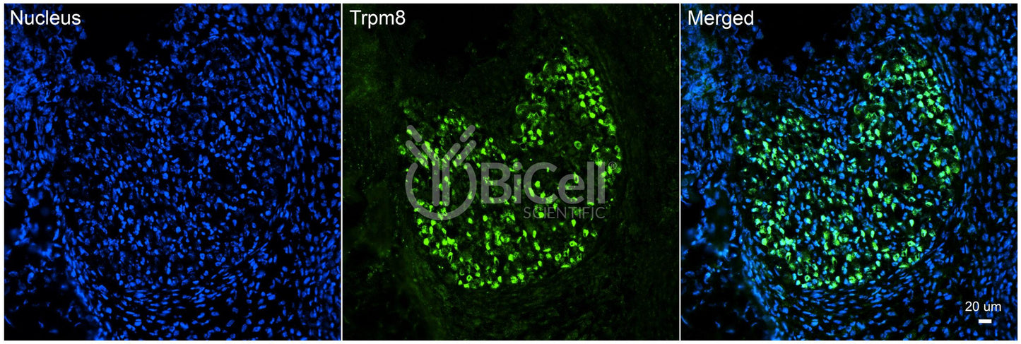 Trpm8 Antibody