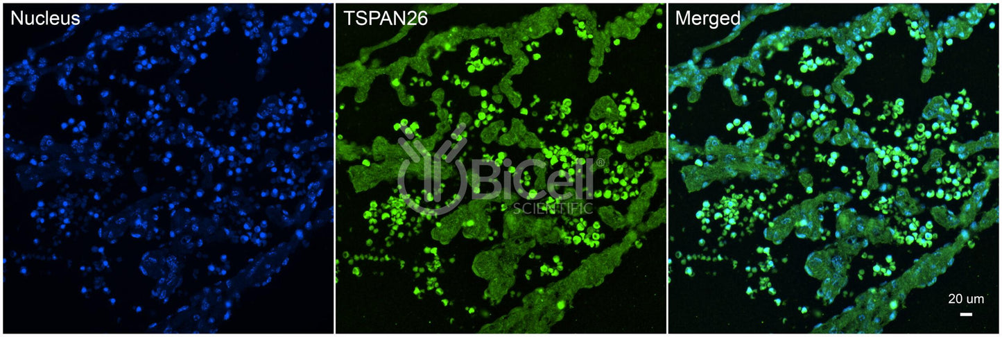 Tetraspanin-26 (TSPAN26 or CD37) Antibody - Western Blot Validated