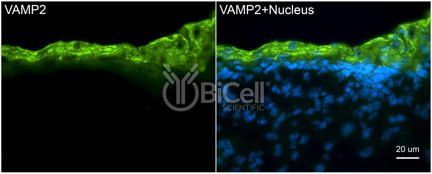 VAMP2 (SYB2) Antibody