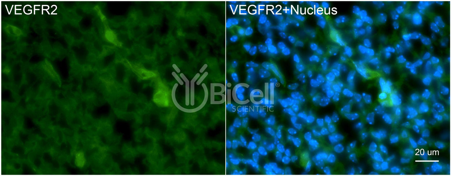 VEGFR2 (KDR or FLK1 or CD309) Antibody - Western Blot Validated