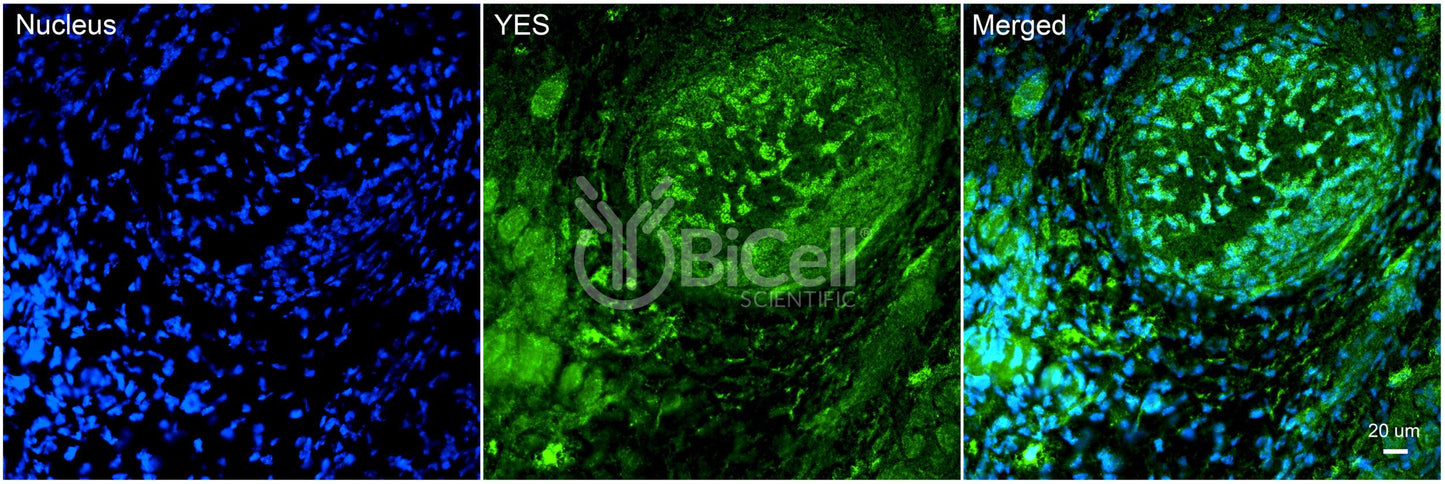 YES (YES1) Antibody - Western Blot Validated