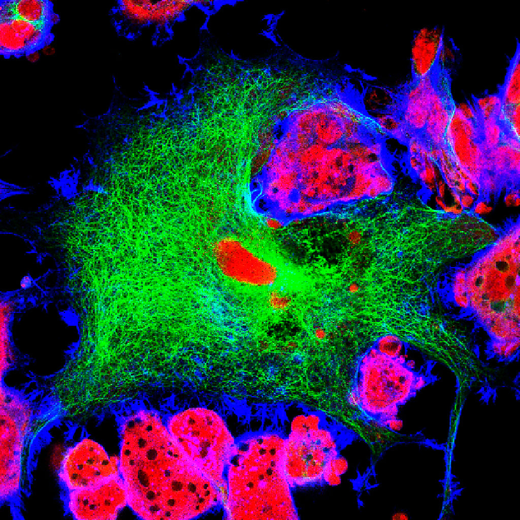 Immunofluorescence