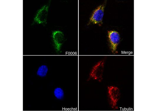 NF-κB p65 Antibody
