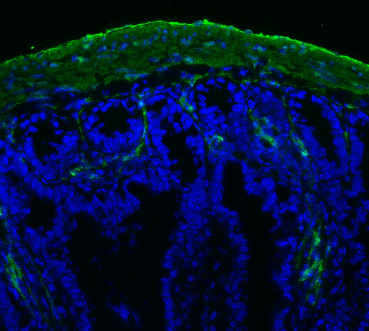 α-Smooth Muscle Actin Antibody