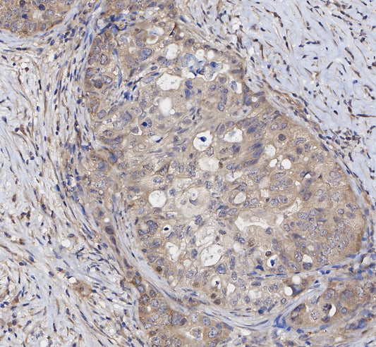 Beclin 1 Antibody