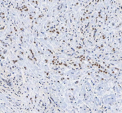 Histone H3 (di methyl Lys9) Antibody