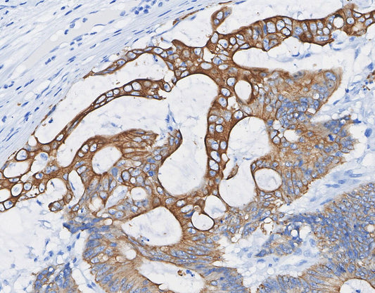 Phospho-Tau (Ser202/Thr205) Antibody