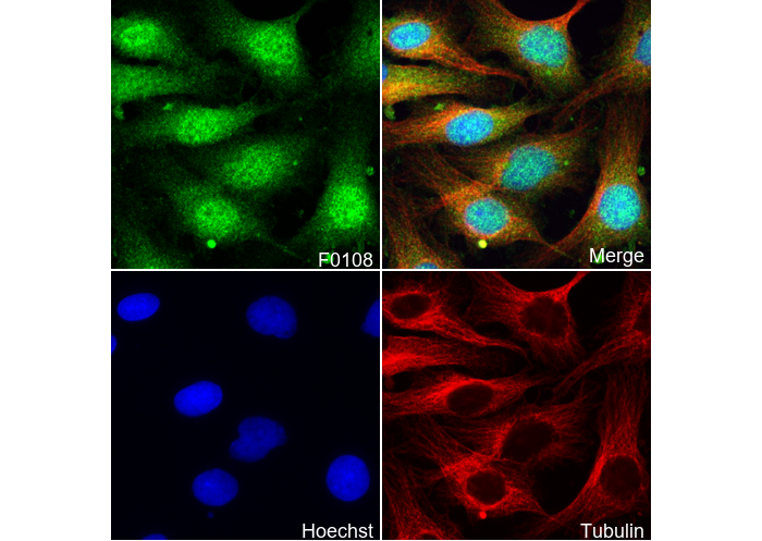 Tyrosine Hydroxylase Antibody