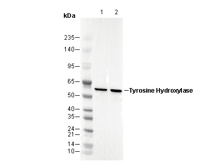 Tyrosine Hydroxylase Antibody