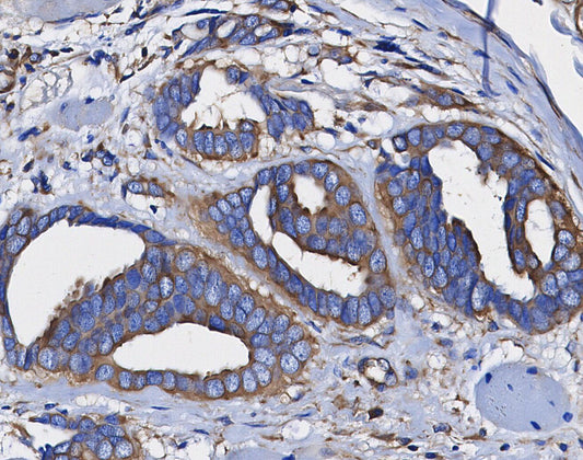 Bcl-2 Antibody