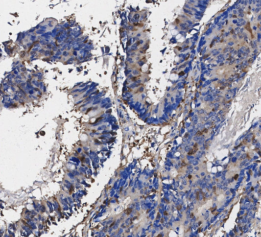 4E-BP1 Antibody