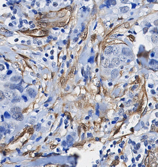 CD31 (PECAM-1) Antibody