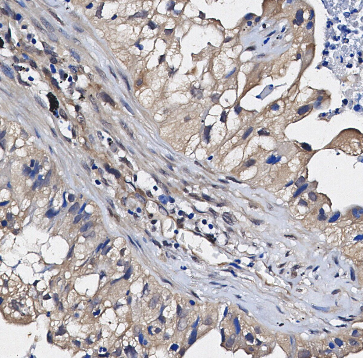 LC3A/B Antibody