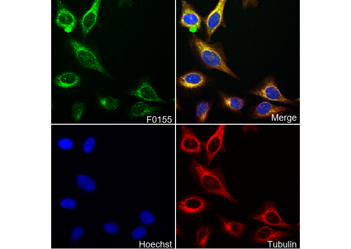 Phospho-NF-κB p65 (Ser536) Antibody