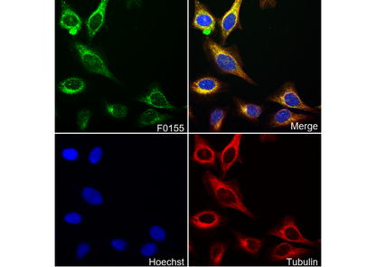 Phospho-NF-κB p65 (Ser536) Antibody