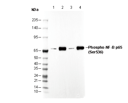 Phospho-NF-κB p65 (Ser536) Antibody
