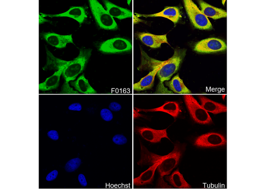 S6 Ribosomal Protein Antibody