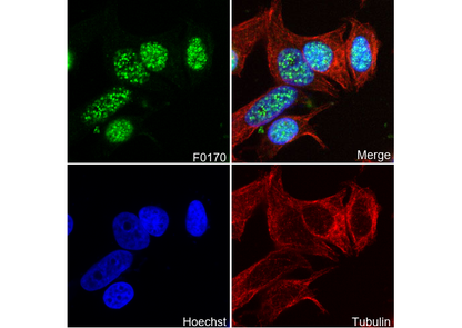 p21 Waf1/Cip1 Antibody