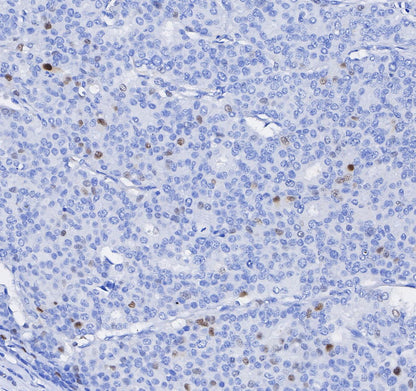 p21 Waf1/Cip1 Antibody