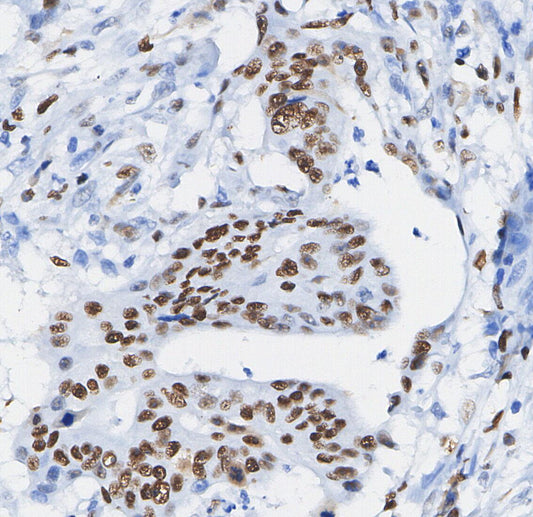 Cyclin D3 Antibody