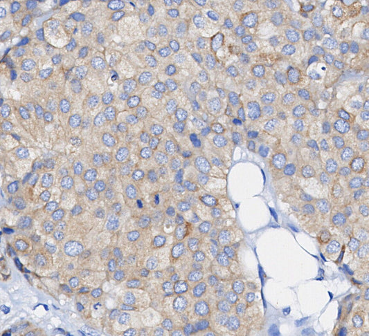 Fatty Acid Synthase Antibody