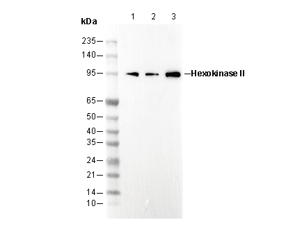 Hexokinase II Antibody